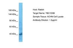 TBC1D9B Rabbit anti-Human, Polyclonal, Novus Biologicals 0.1 mL | Buy Online | Novus Biologicals | Fisher Scientific